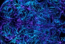 neural hyper beam technology